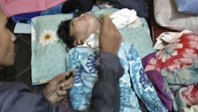 Bantu Mega bernafas dengan lubang dilehernya