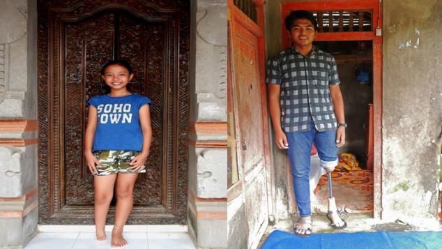 Bantu Komang & Devita Remaja Dengan Disabilitas