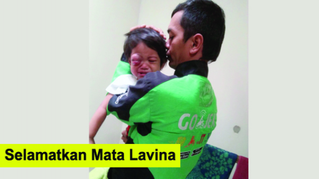 Bantu Selamatkan Mata Lavina