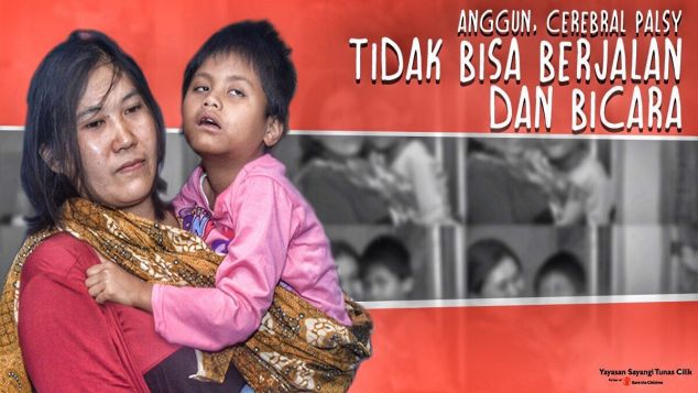 Terapi untuk Anggun Penderita Cerebral Palsy