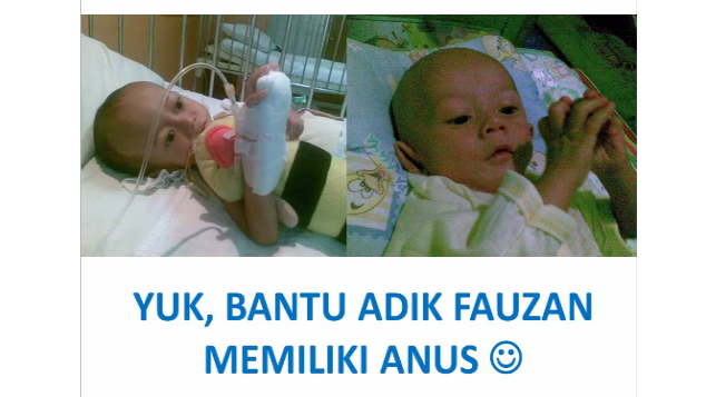 YUK, BANTU ADIK FAUZAN MEMILIKI ANUS