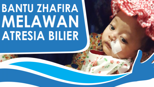 Bantu Zhafira Untuk Operasi Transplantasi Hati