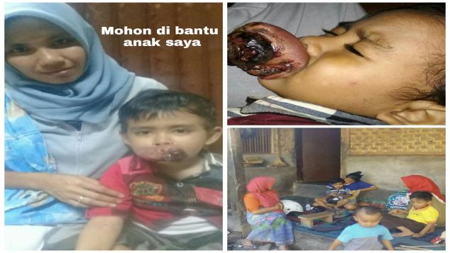 Bantu Dani sembuh dari kanker mulut
