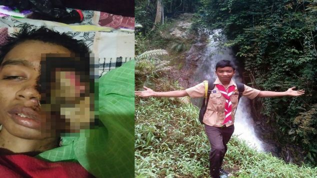 bantu adek haris melawan Tumor