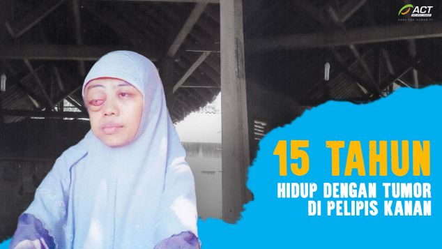 Sembuhkan mata Parti untuk bisa melihat lagi