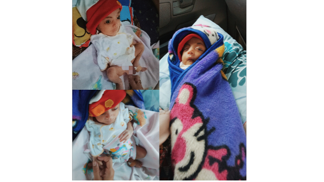 Bantu Bayi Cantik Fakhira Bebas Dari Atresia Ani