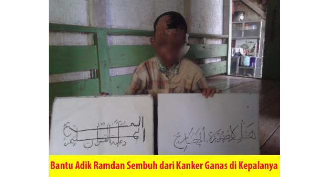Bantu Adik Ramdan Sembuh Dari Kanker Ganas