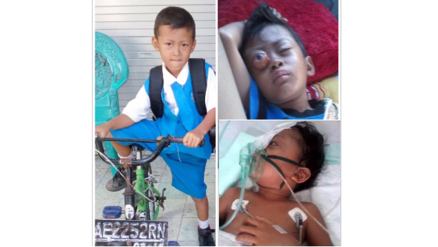 Bantu biaya operasi&pengobatan; adik Ilham Saputra