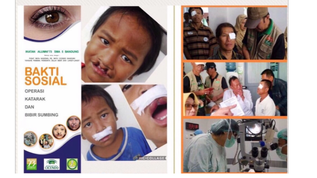 BANTU BAKSOS KATARAK & BIBIR SUMBING IKA 73 SMA 5