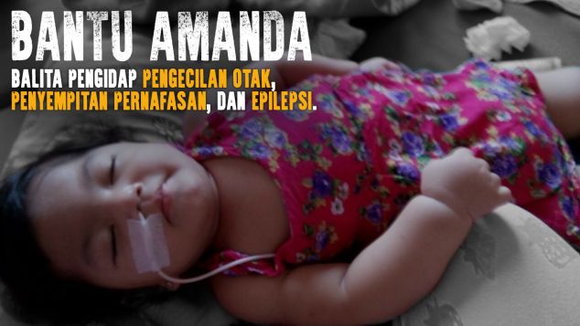 Balita Amanda Pengidap Pengecilan Otak & Epilepsi