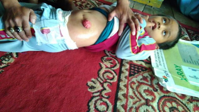 Save Tendi Nurhalim