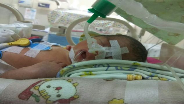 Bantu bayi Annasya agar tetap bernapas