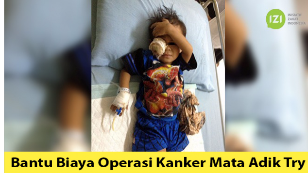 Bantu Biaya Operasi Kanker Mata Adik Try