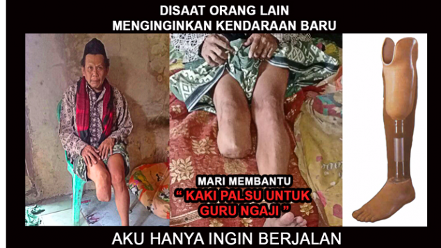 Kaki Palsu Untuk Guru Ngaji
