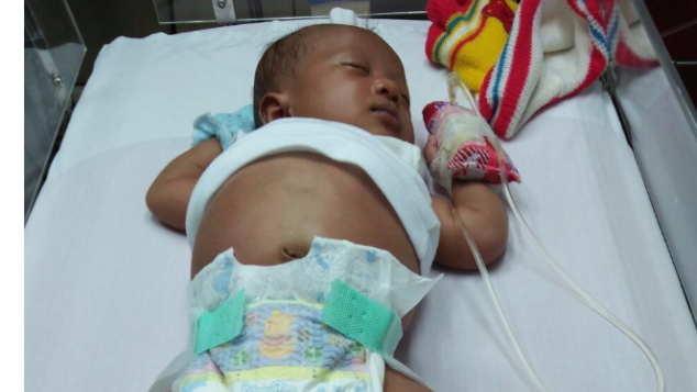 Ayo bantu Arsyila melawan Hirschsprung!