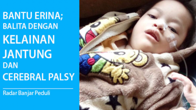 Bantu Erina, Balita dengan Kelainan Jantung