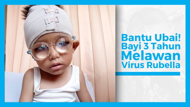 Batita penderita buta dan tuli akibat Rubella