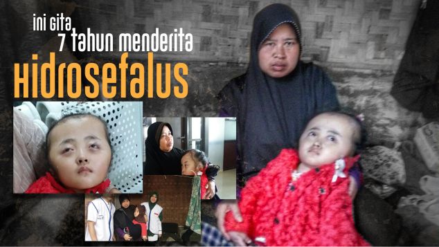 Bantu Gita Melawan Sakit Yang Dideritanya