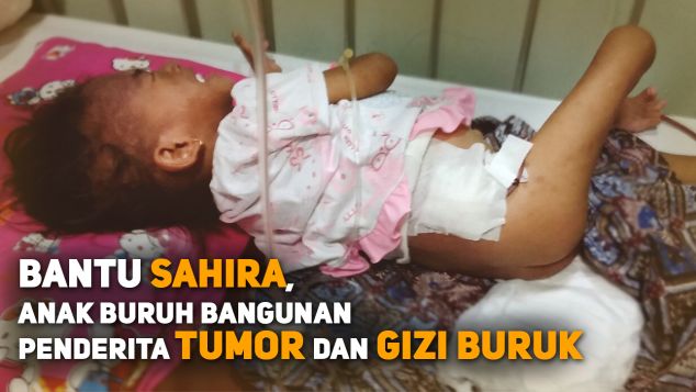 Bantu Sahira Balita Penderita Tumor dan Gizi Buruk