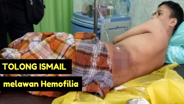 Bantu Operasi Luka Ismail Penderita Hemofilia