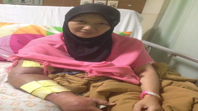 Bantu Ibu Nanih Melawan Kanker