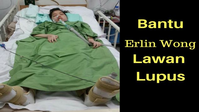 Lupus Merenggut Masa Depan Erlin Wong