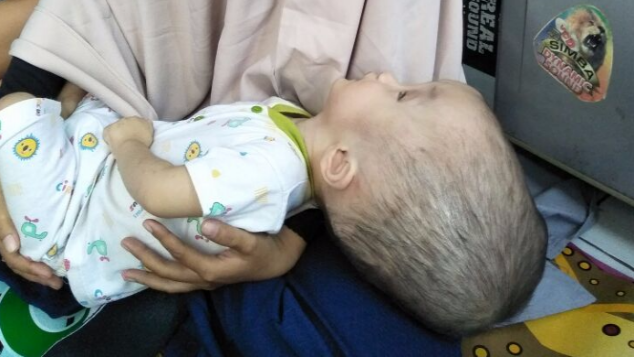 Kesembuhan untuk Raihan, Pengidap Hidrocefalus