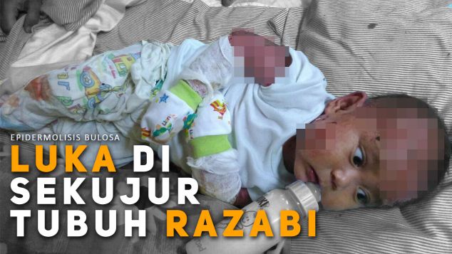 Sembuhkan Adik Razabi