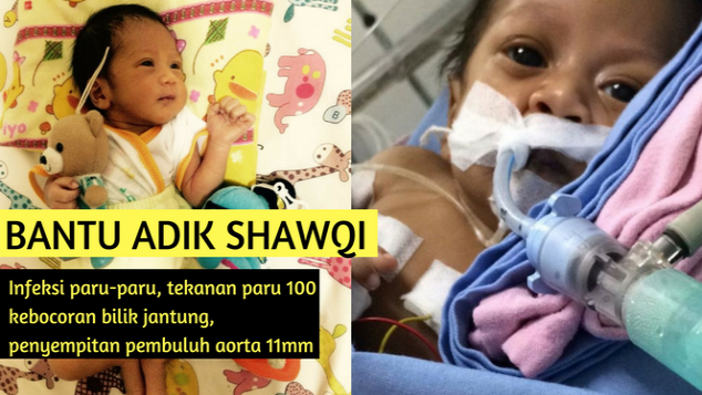 Bantu Baby Shawqi Sembuh dari VSD CoA