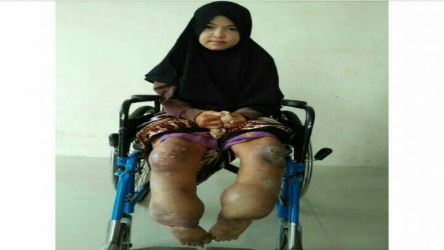 10.000 akan sangat berarti untuk IMAS SUMARNI