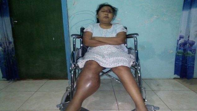 Bantu kesembuhan saudari farid melawan tumor