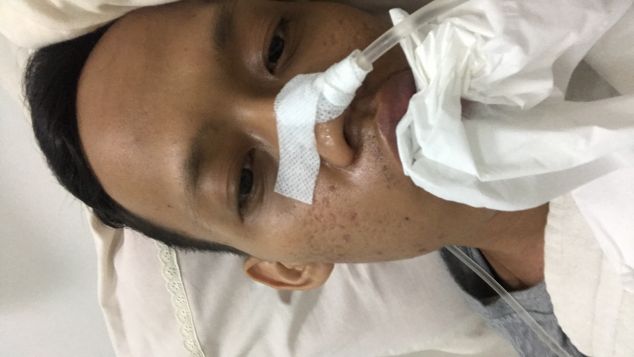 Mohon Bantuan Biaya Perawatan Kanker Lidah saya