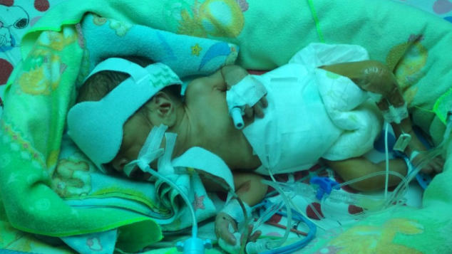 Bantu Bayi Khairan yang Lahir Prematur