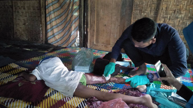 Bantu Anak Luka Bakar dari keluarga Tuna Netra
