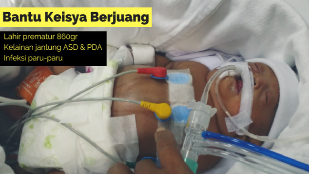 Perjuangan Keisya Melawan Penyakit Sejak BB 860gr