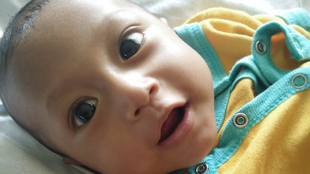 Bantu Sakha Lawan Atresia Bilier