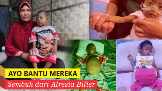 Ayo Bantu Mereka Sembuh dari Atresia Bilier