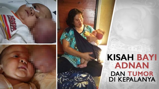 Bantu Adnan Untuk melihat lengkap