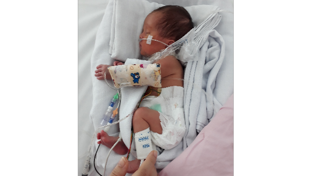 Tolong Bayi Shalomita sembuh dari Atresia Esofagus