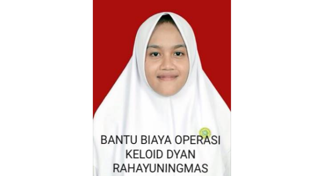 Biaya Operasi Keloid Dyan Rahayuningmas Biaya Operasi Keloid Dyan Rahayuningmas