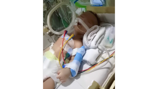 Tolong Buah Hati Ku Abidzar dari Stenosis Pilorus