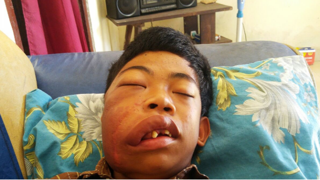 Bantu Biaya Operasi Afandi