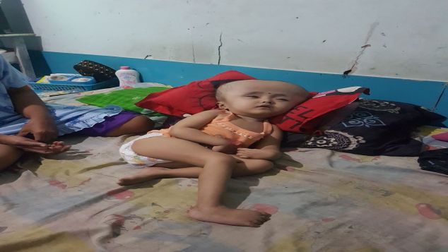 bantu sally melawan penyakit hydrocepalus