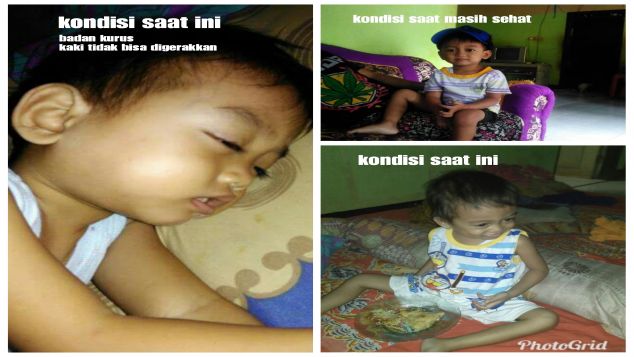 Bantu Vero dari leukimia