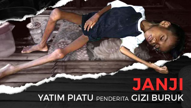 Kisah Janji, Yatim Piatu Penderita Gizi Buruk