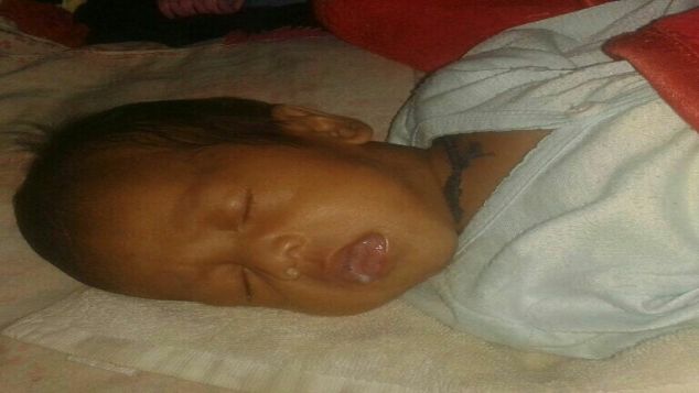 BANTU ANAK SAYA KELAINAN TANPA ANAK TEKAK