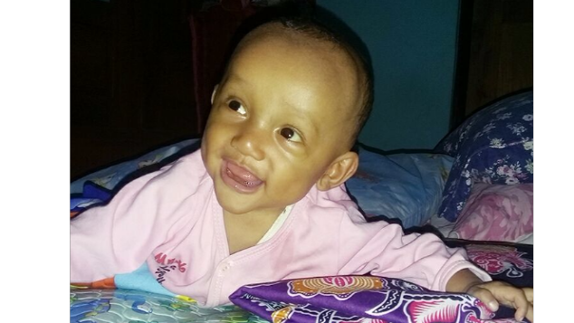 Demi Senyum Adik Abyan Penderita Atresiabilier