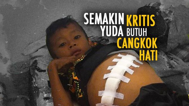 Berikan Hati Untuk Adik Yudha