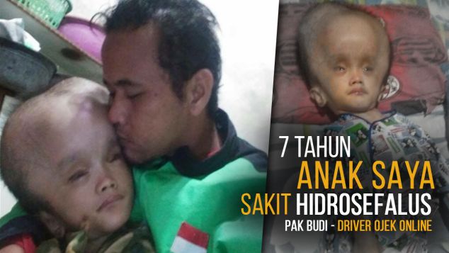 Driver Ojek Online, 7thn Merawat Anak Hidrosefalus