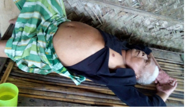 Bantu Bah Bayay Sehat Kembali